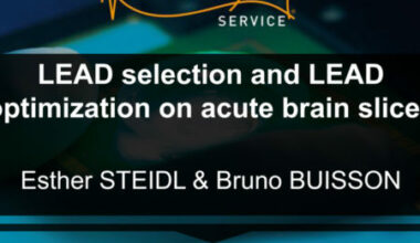 LEad selection and optimization neuroservice