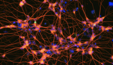 Sample Human ipsc derived neurons