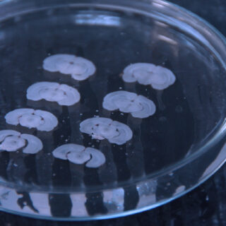 Rodent brain slices in a dish