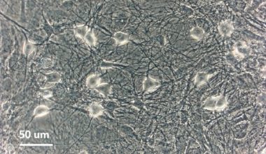 ipsc derived sensory neurons after 7 days in vitro