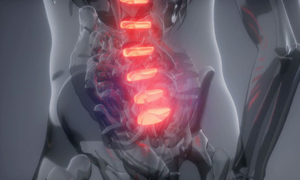 Back pain in spinal cord