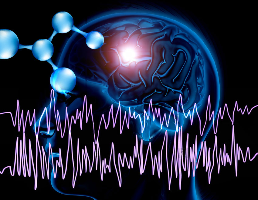 Brain with seizure EEG traces