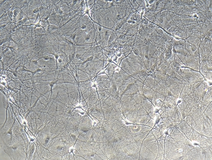 rat cortical neuronal cells cultures