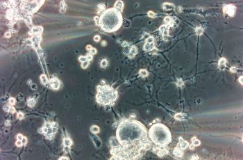 Leverage our expertise to study Nav 1.8 blockers