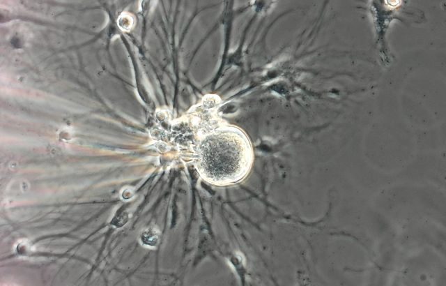 DRG Sensory neuron recoding using patch clamp technique
