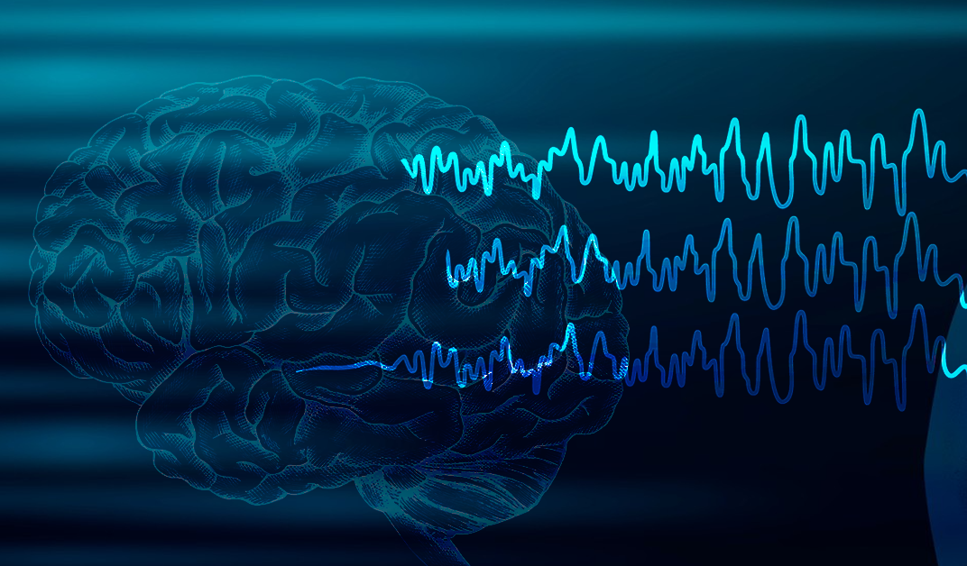 Epileptic discharges