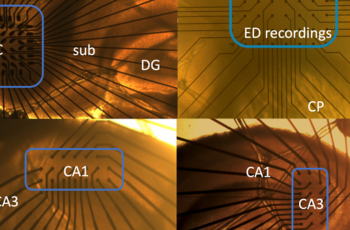 Microelectrode arrays (MEA), an ideal platform for translational epilepsy research and drug profiling