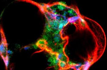 Advancing Alzheimer’s Research Through Human Brain Organoids