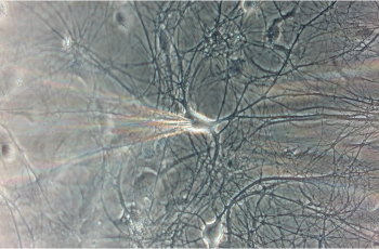 NMDA Receptor Currents in Rat Cortical Neurons for Drug Discovery