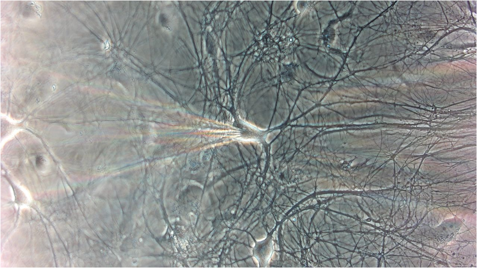 Microscopic image of rat neurons