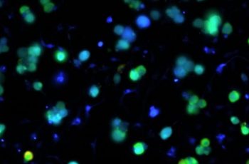 Cell Electrophysiology in Drug Discovery: Functional Assays and Endpoints Across Neuron Models