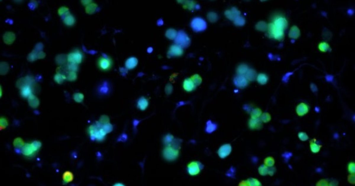 Calcium imaging microscopic image