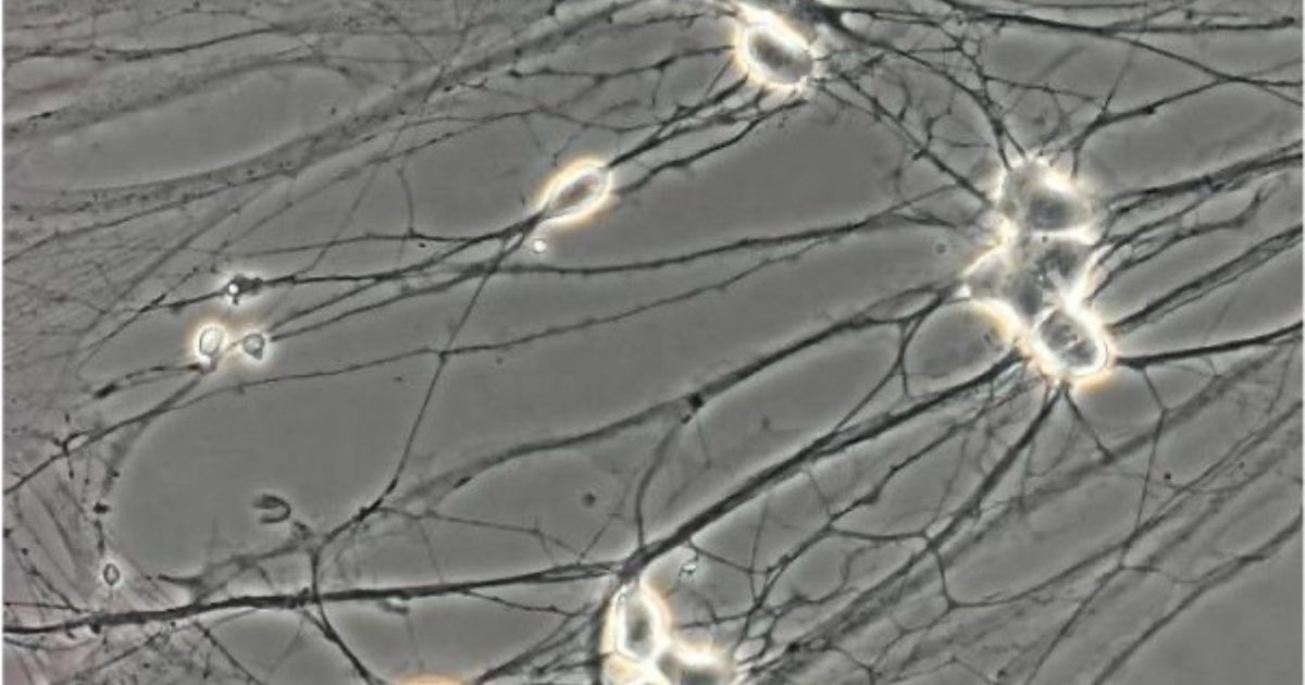 iPSC cell culture microscopic image