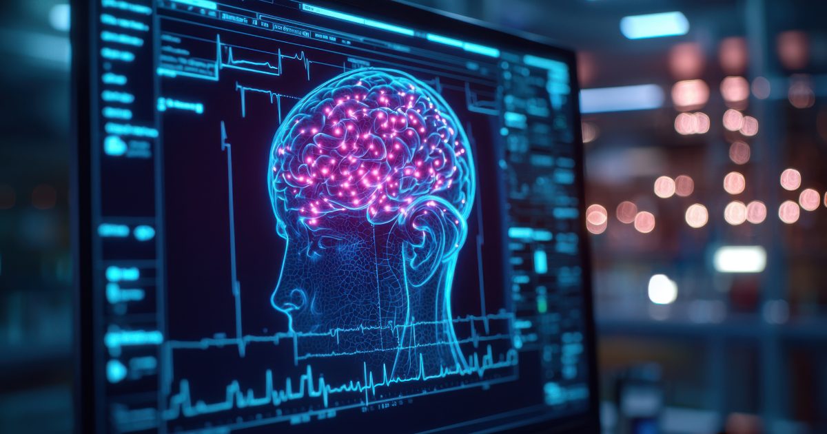 3D computer generated image of brain scan on a computer