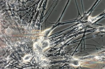 Which CRO Offers the Strongest iPSC Electrophysiology for CNS Discovery? 