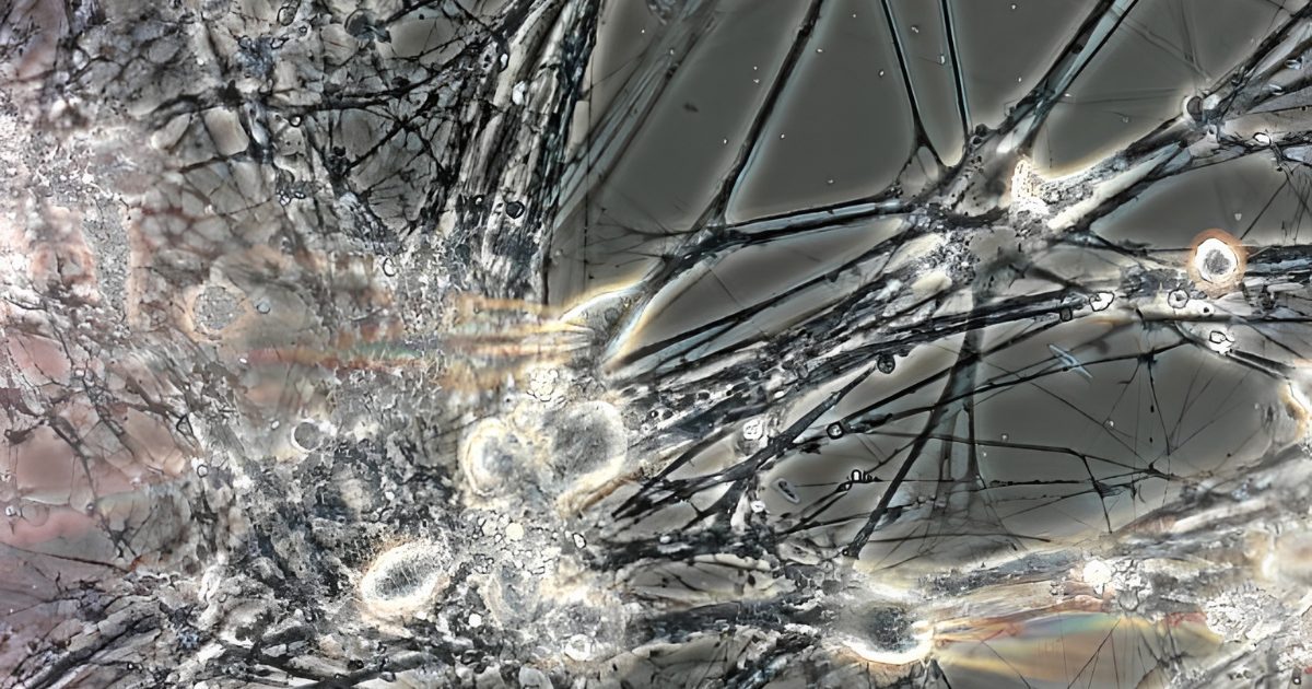 iPSC Neurons on microscrope